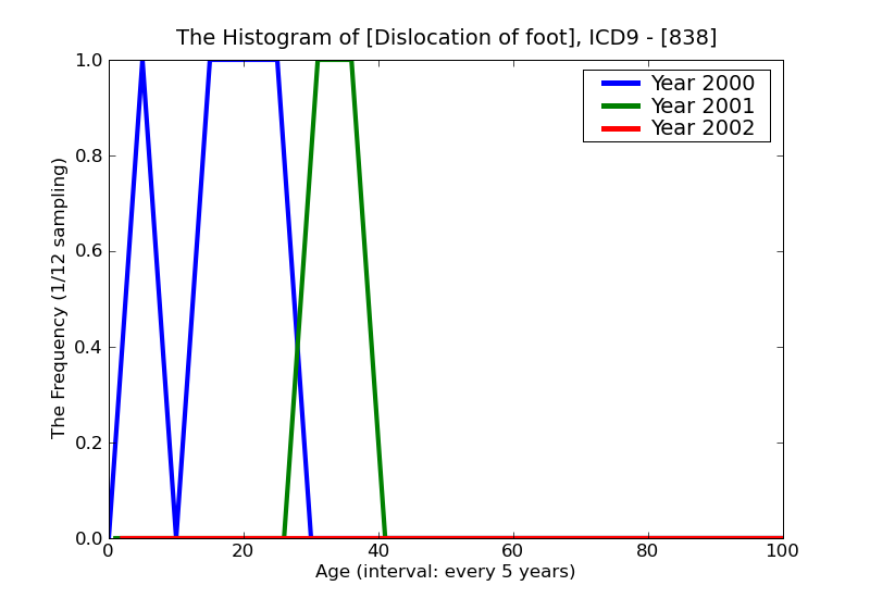 ICD9 Histogram Dislocation of foot
