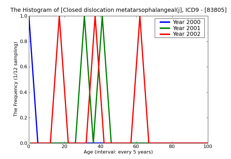 ICD9 Histogram Closed dislocation metatarsophalangeal(joint)