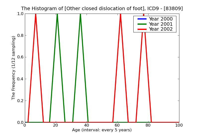 ICD9 Histogram Other closed dislocation of foot