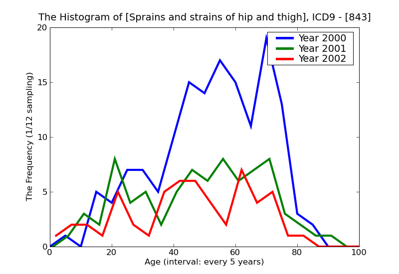 ICD9 Histogram Sprains and strains of hip and thigh