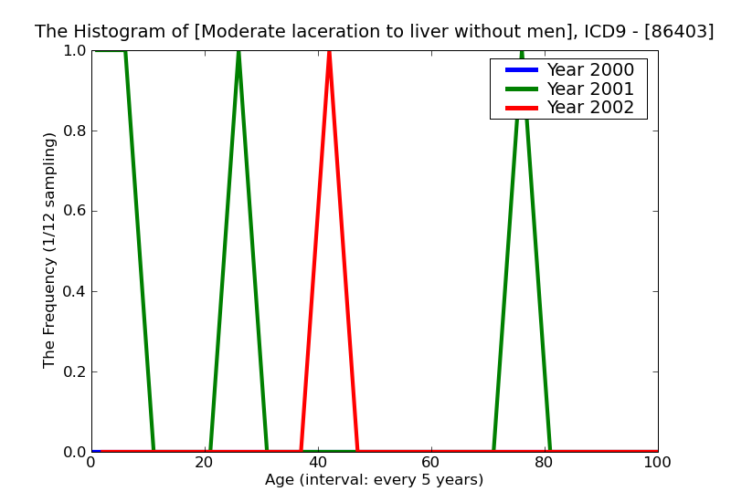 ICD9 Histogram Moderate laceration to liver without mention of open wound into cavity