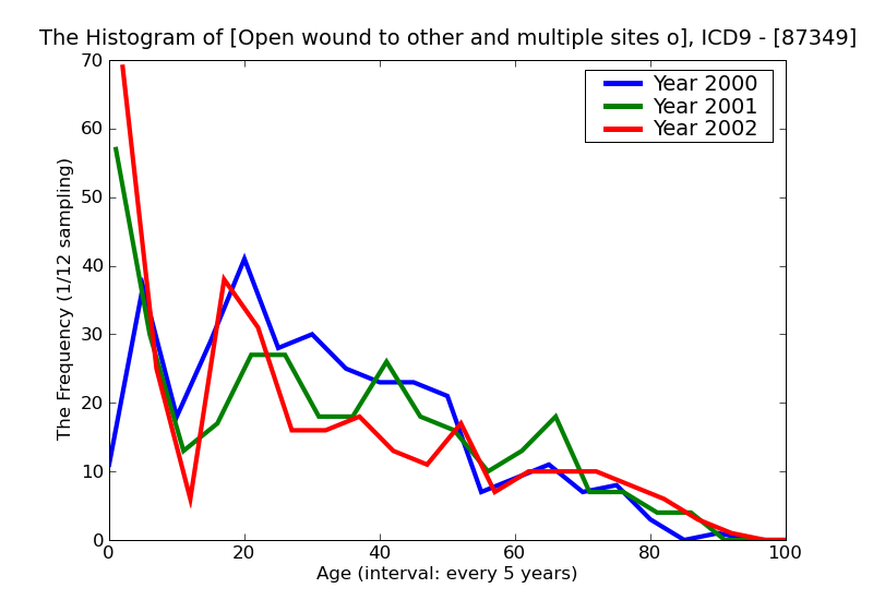 ICD9 Histogram Open wound to other and multiple sites of face without mention of complication