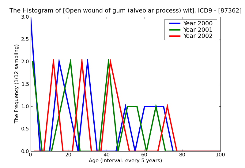 ICD9 Histogram Open wound of gum (alveolar process) without mention of complication