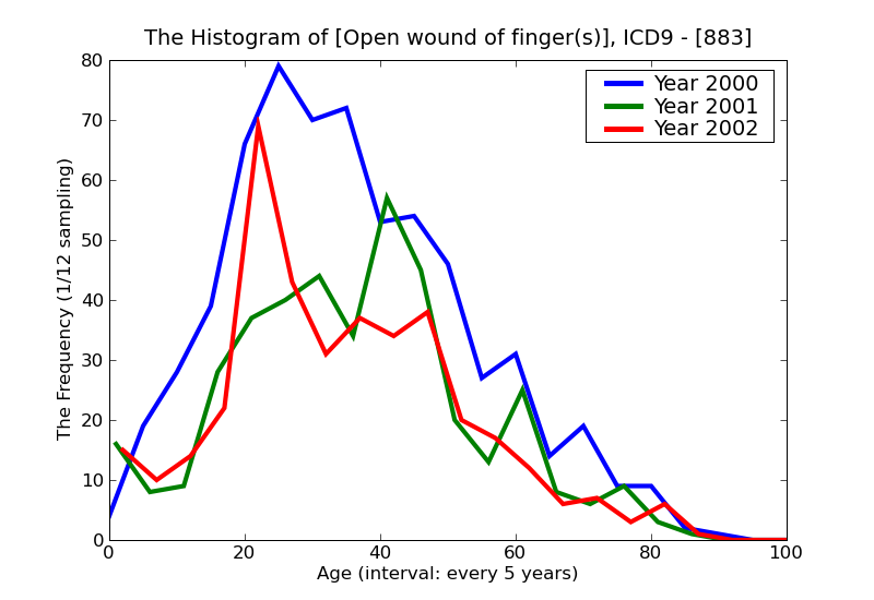 ICD9 Histogram Open wound of finger(s)