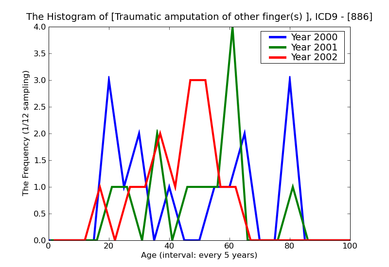 ICD9 Histogram Traumatic amputation of other finger(s) (complete) (partial)