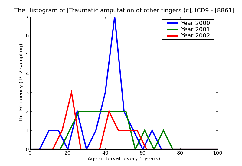 ICD9 Histogram Traumatic amputation of other fingers (complete) (partial) complicated