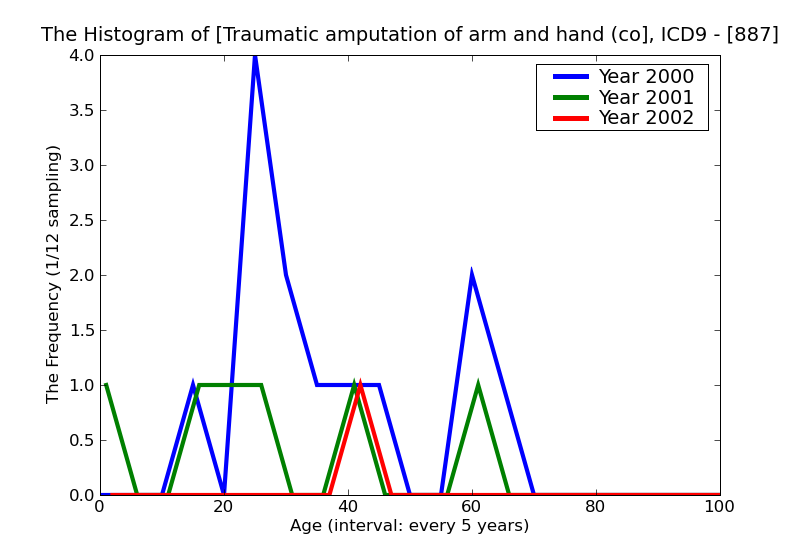 ICD9 Histogram Traumatic amputation of arm and hand (complete) (partial)