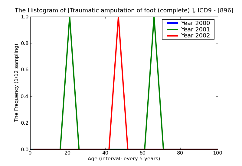 ICD9 Histogram Traumatic amputation of foot (complete) (partial)