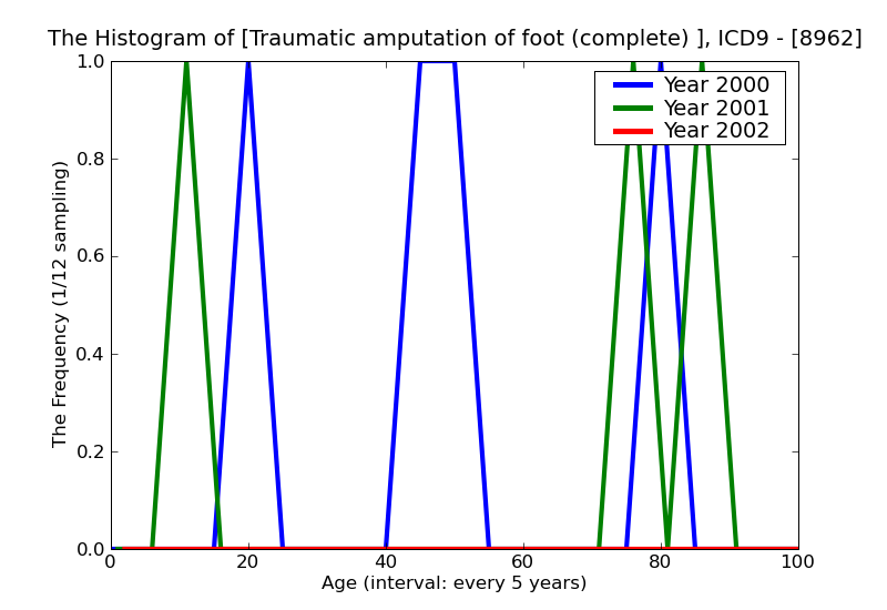 ICD9 Histogram Traumatic amputation of foot (complete) (partial) bilateral without mention of complication