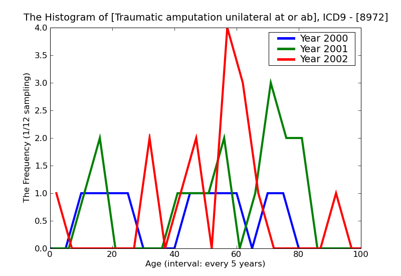 ICD9 Histogram Traumatic amputation unilateral at or above knee without mention of complication