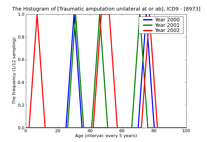 ICD9 Histogram Traumatic amputation unilateral at or above knee complicated
