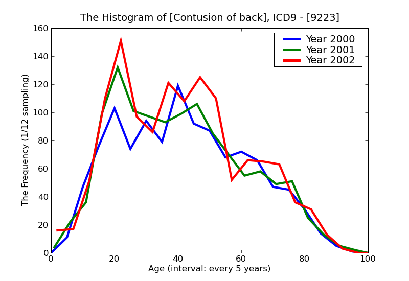 ICD9 Histogram Contusion of back