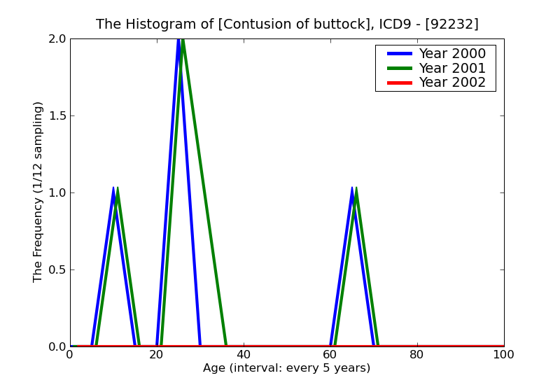 ICD9 Histogram Contusion of buttock