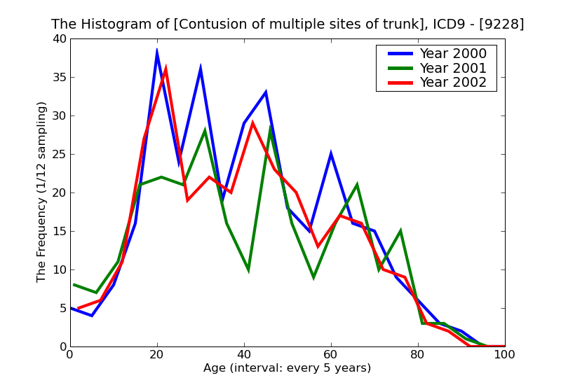 ICD9 Histogram Contusion of multiple sites of trunk