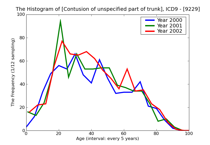 ICD9 Histogram Contusion of unspecified part of trunk