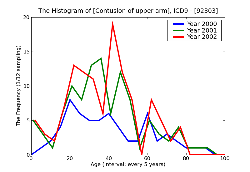 ICD9 Histogram Contusion of upper arm