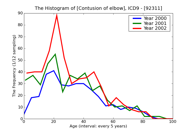 ICD9 Histogram Contusion of elbow