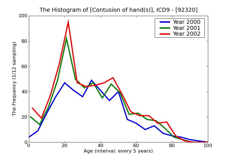 ICD9 Histogram Contusion of hand(s)