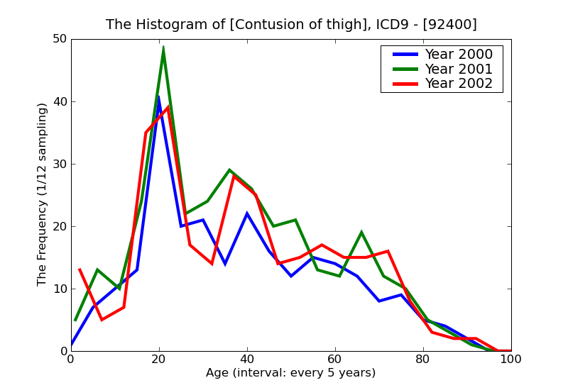 ICD9 Histogram Contusion of thigh
