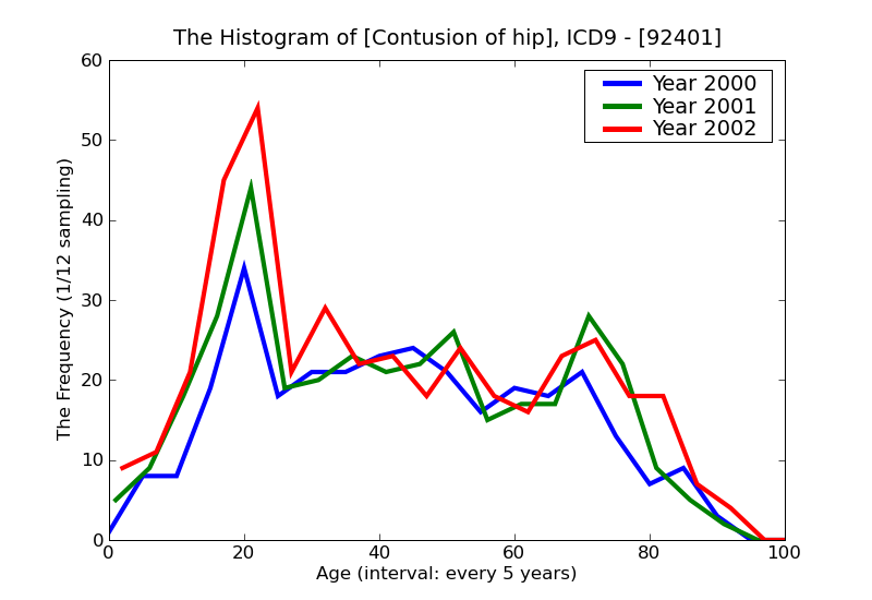 ICD9 Histogram Contusion of hip