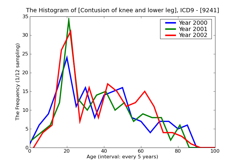 ICD9 Histogram Contusion of knee and lower leg