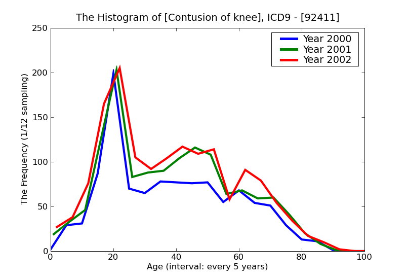 ICD9 Histogram Contusion of knee