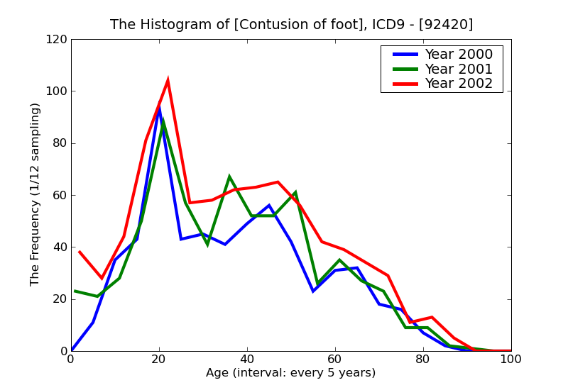 ICD9 Histogram Contusion of foot