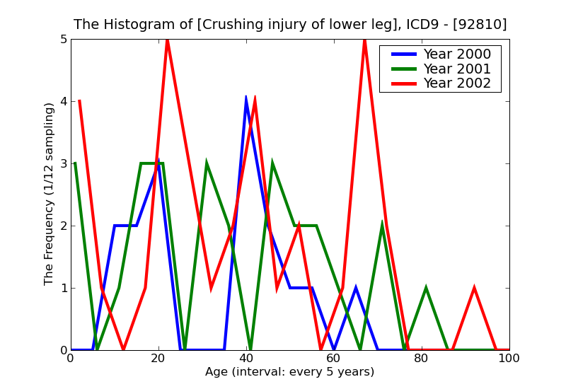 ICD9 Histogram Crushing injury of lower leg