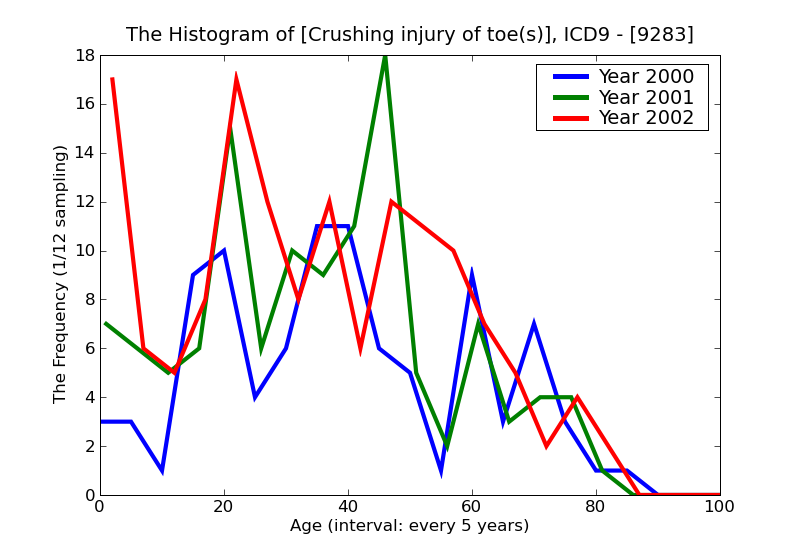 ICD9 Histogram Crushing injury of toe(s)