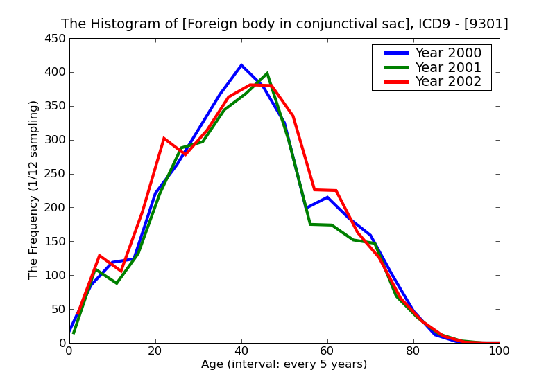 ICD9 Histogram Foreign body in conjunctival sac