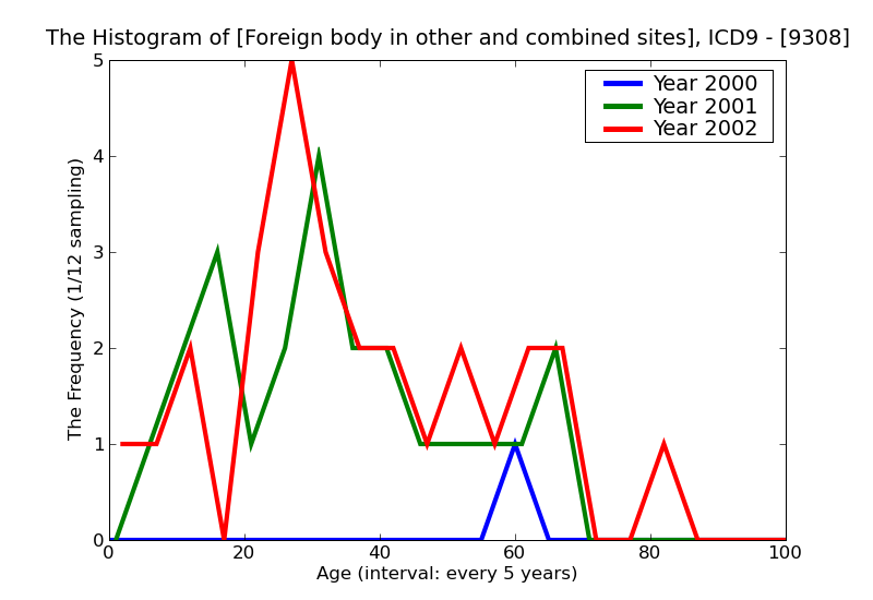 ICD9 Histogram Foreign body in other and combined sites of external eye