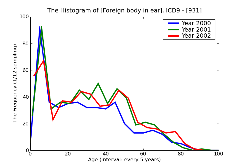 ICD9 Histogram Foreign body in ear