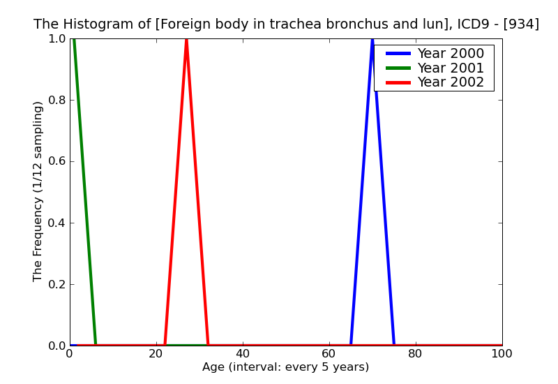 ICD9 Histogram Foreign body in trachea bronchus and lung