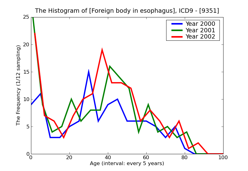 ICD9 Histogram Foreign body in esophagus