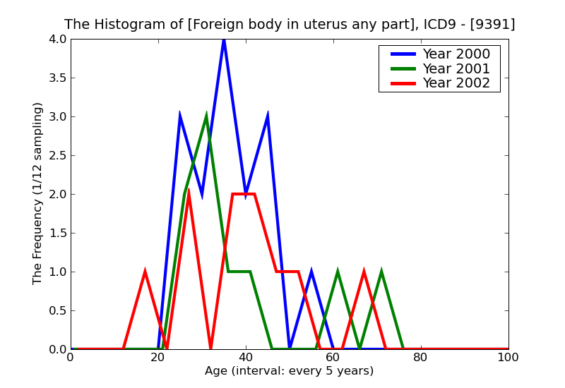 ICD9 Histogram Foreign body in uterus any part