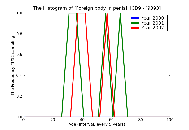 ICD9 Histogram Foreign body in penis
