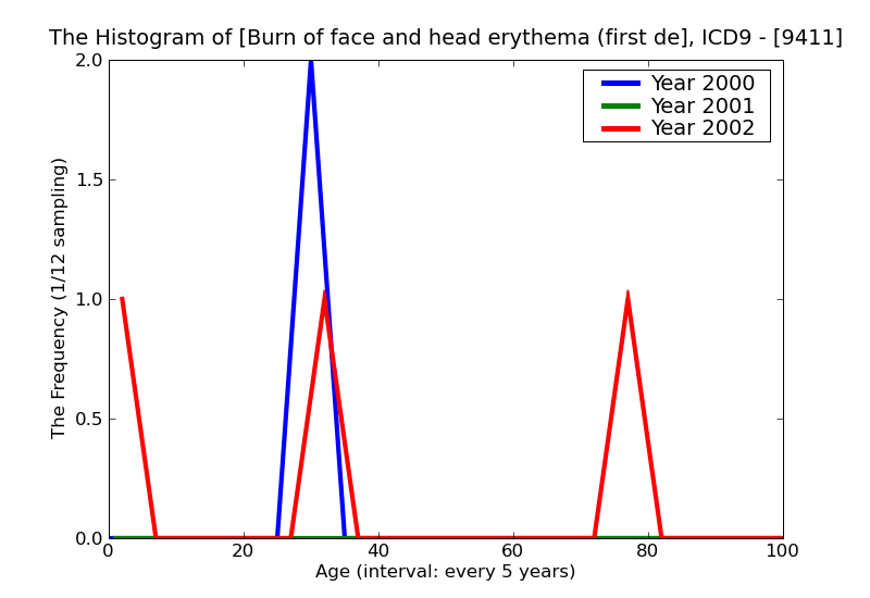 ICD9 Histogram Burn of face and head erythema (first degree)