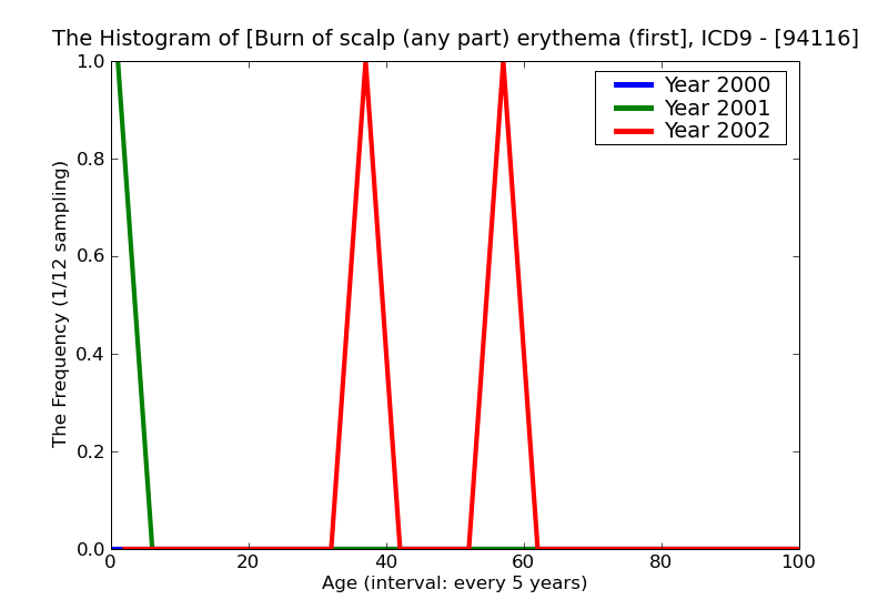 ICD9 Histogram Burn of scalp (any part) erythema (first degree)