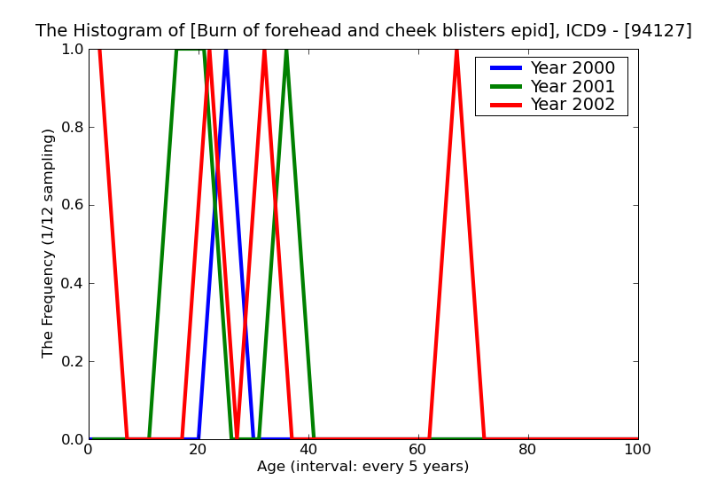 ICD9 Histogram Burn of forehead and cheek blisters epidermal loss (second degree)