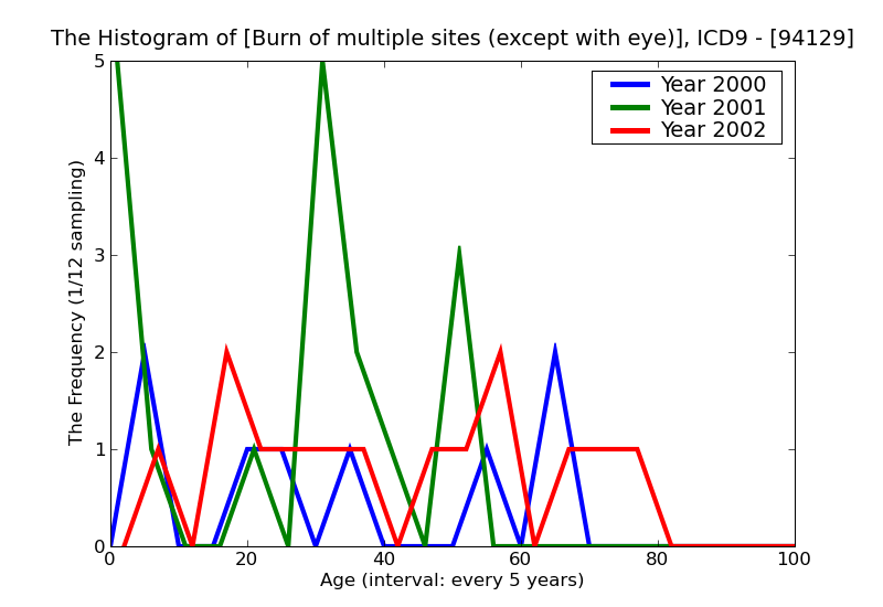ICD9 Histogram Burn of multiple sites (except with eye) of face head and neck blisters epidermal loss (second degre