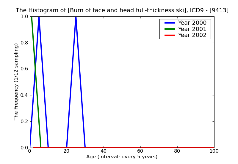 ICD9 Histogram Burn of face and head full-thickness skin loss (third degree NOS)