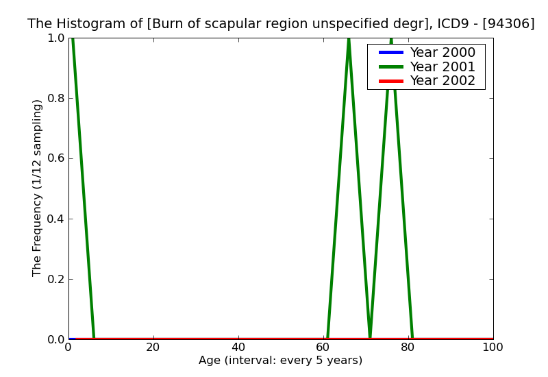 ICD9 Histogram Burn of scapular region unspecified degree