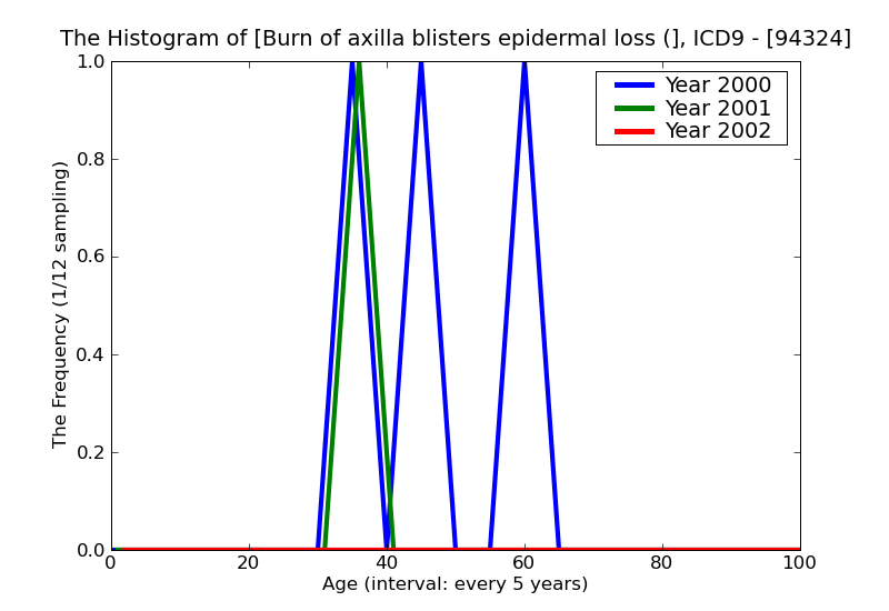 ICD9 Histogram Burn of axilla blisters epidermal loss (second degree)
