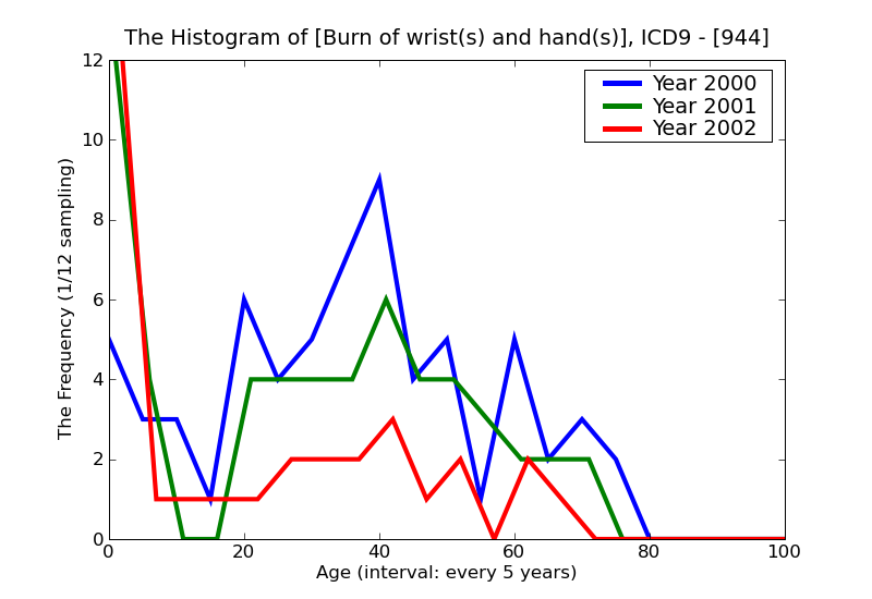 ICD9 Histogram Burn of wrist(s) and hand(s)