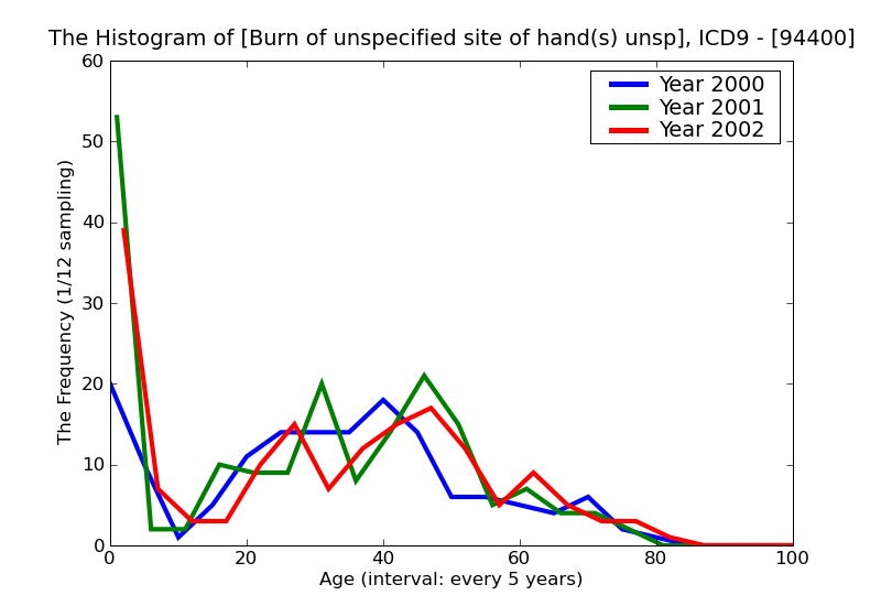 ICD9 Histogram Burn of unspecified site of hand(s) unspecified degree