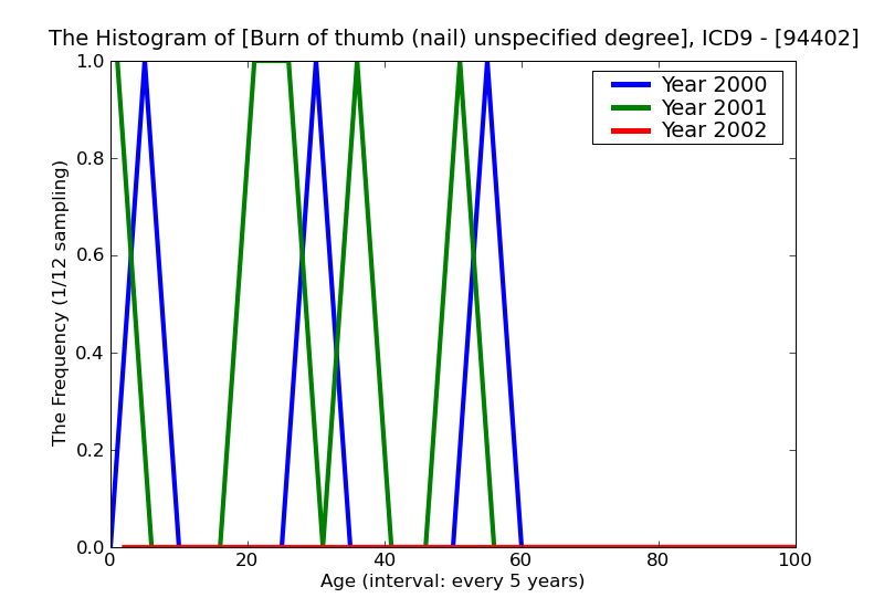 ICD9 Histogram Burn of thumb (nail) unspecified degree