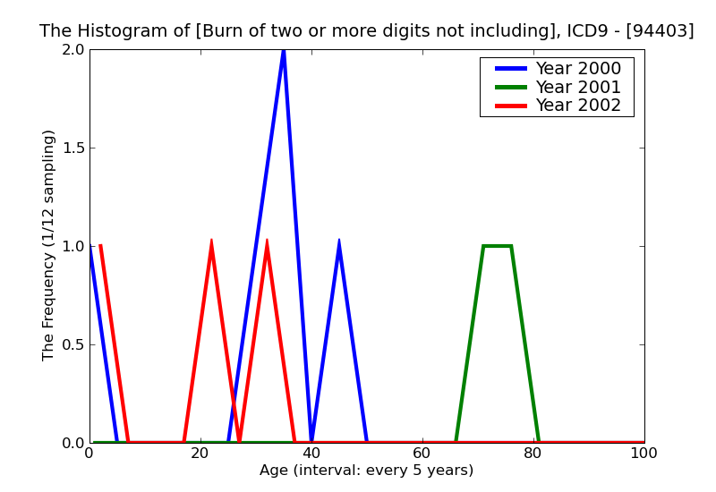 ICD9 Histogram Burn of two or more digits not including thumb unspecified degree