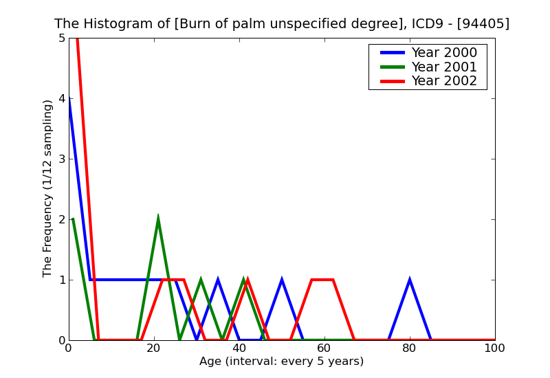ICD9 Histogram Burn of palm unspecified degree