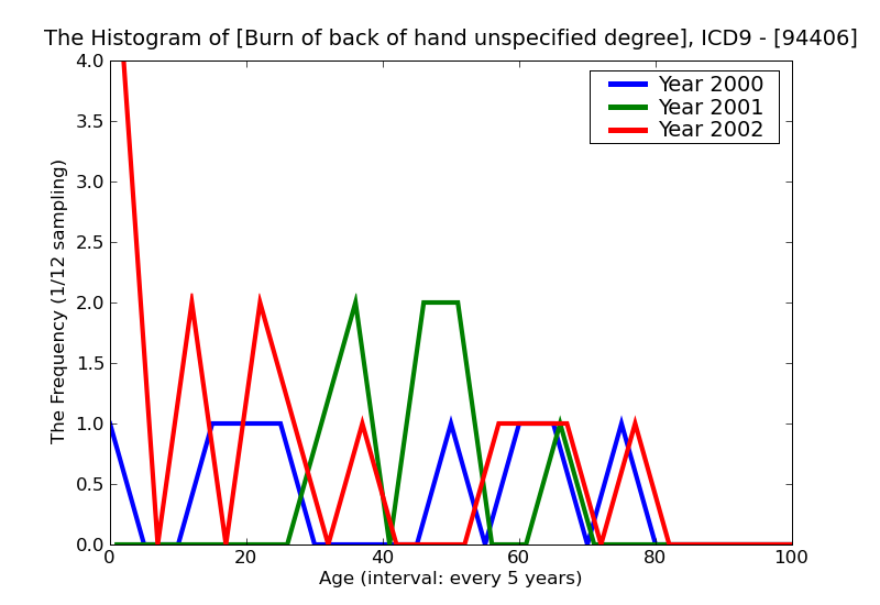 ICD9 Histogram Burn of back of hand unspecified degree