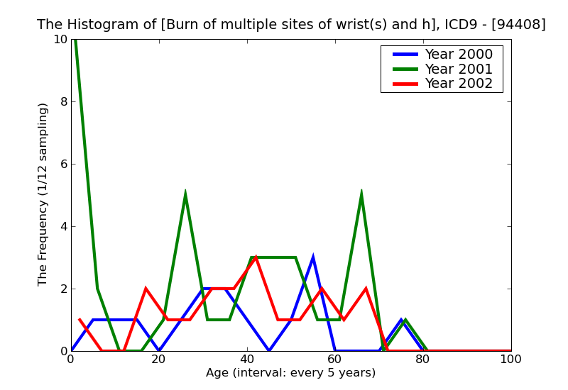 ICD9 Histogram Burn of multiple sites of wrist(s) and hand(s) unspecified degree